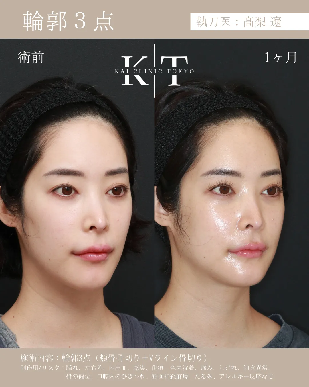 輪郭3点【30代女性】