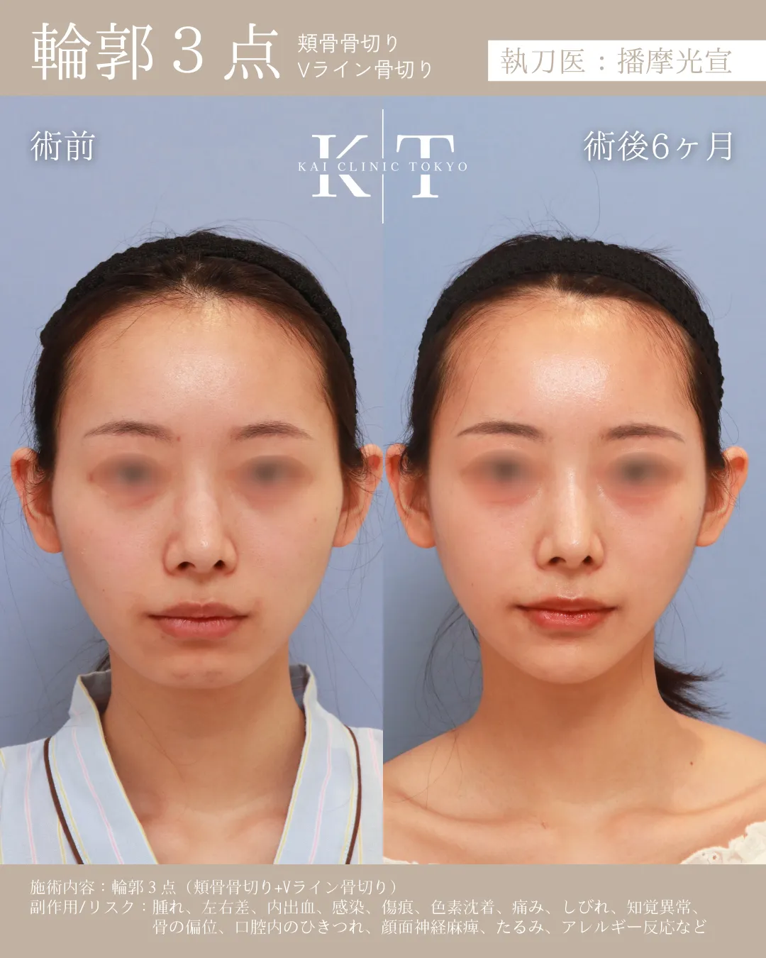 輪郭3点【20代女性】