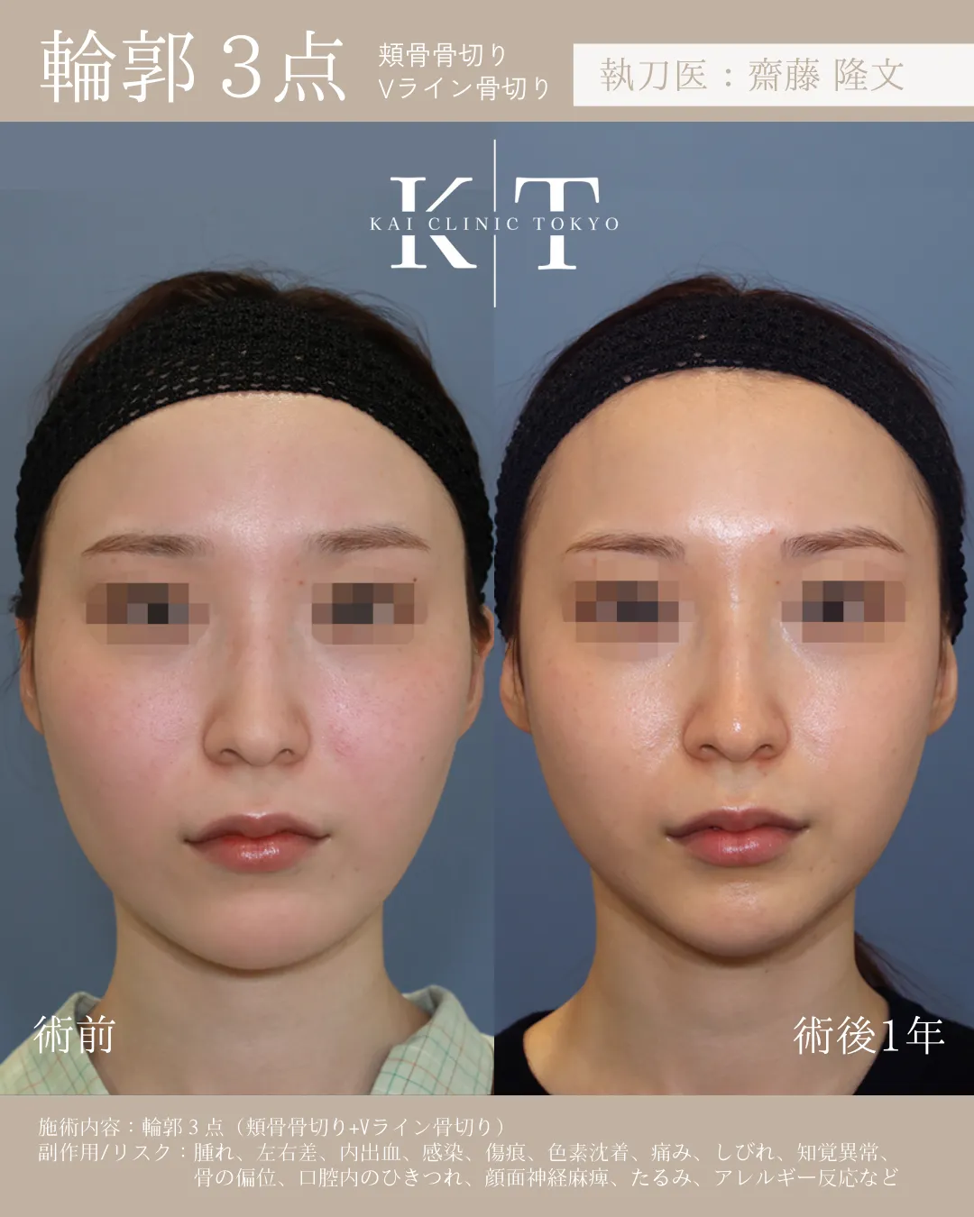 輪郭3点【女性】