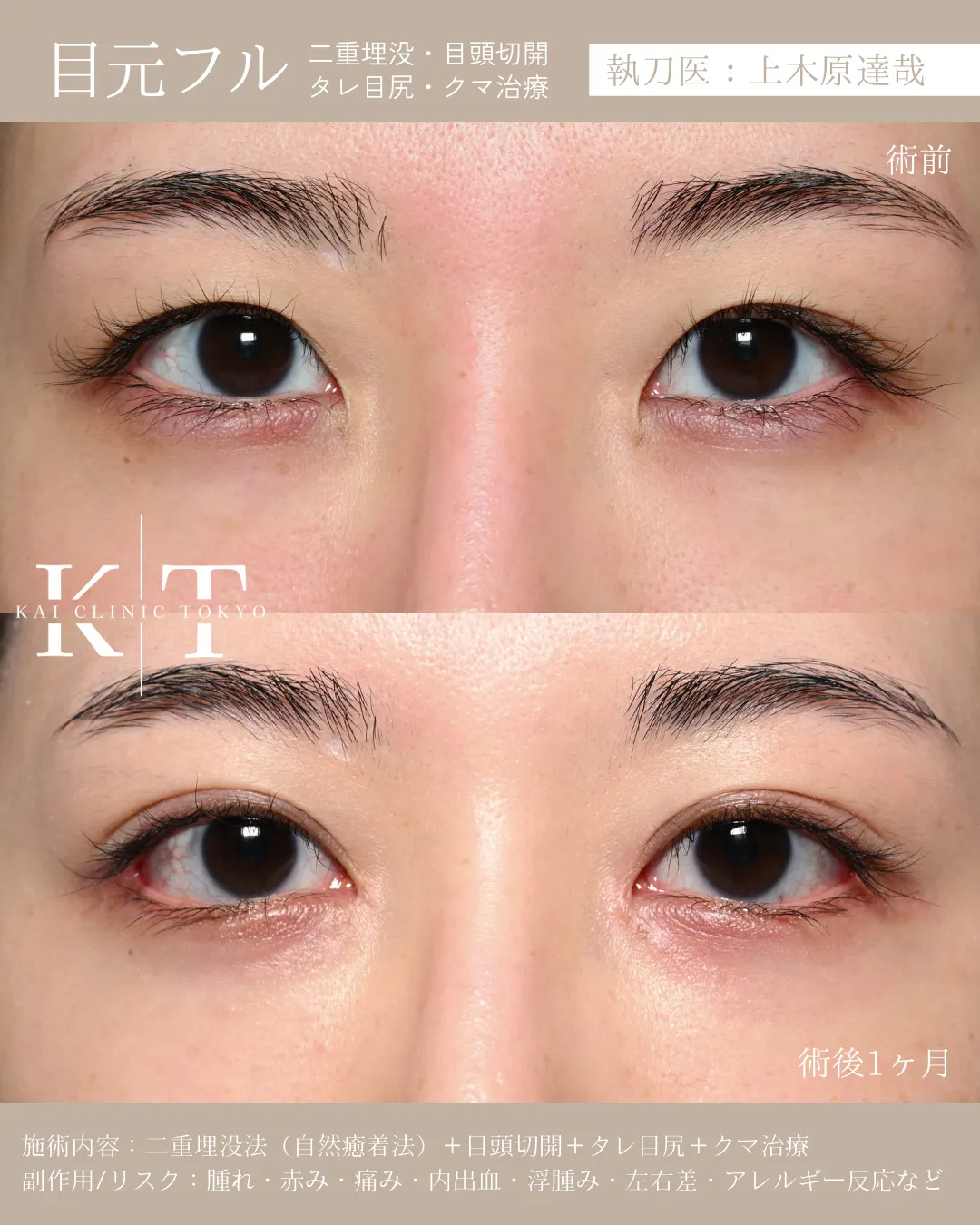 目元フル【女性】