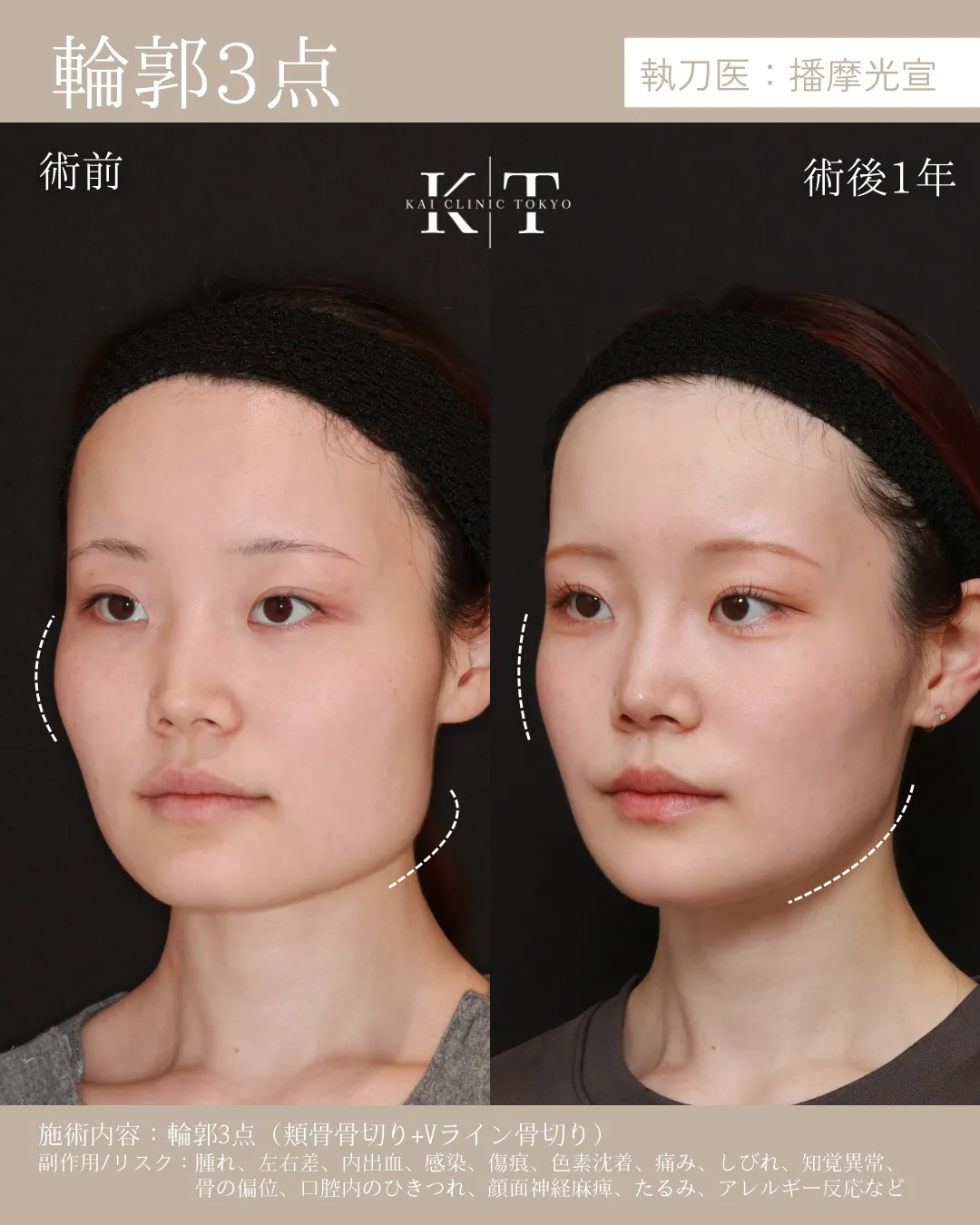 輪郭3点【20代女性】