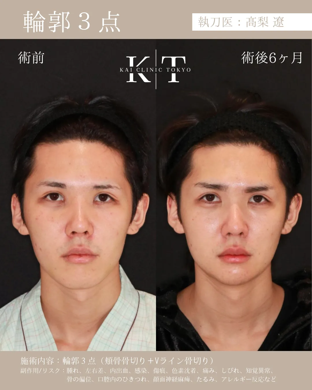 輪郭3点【20代男性】