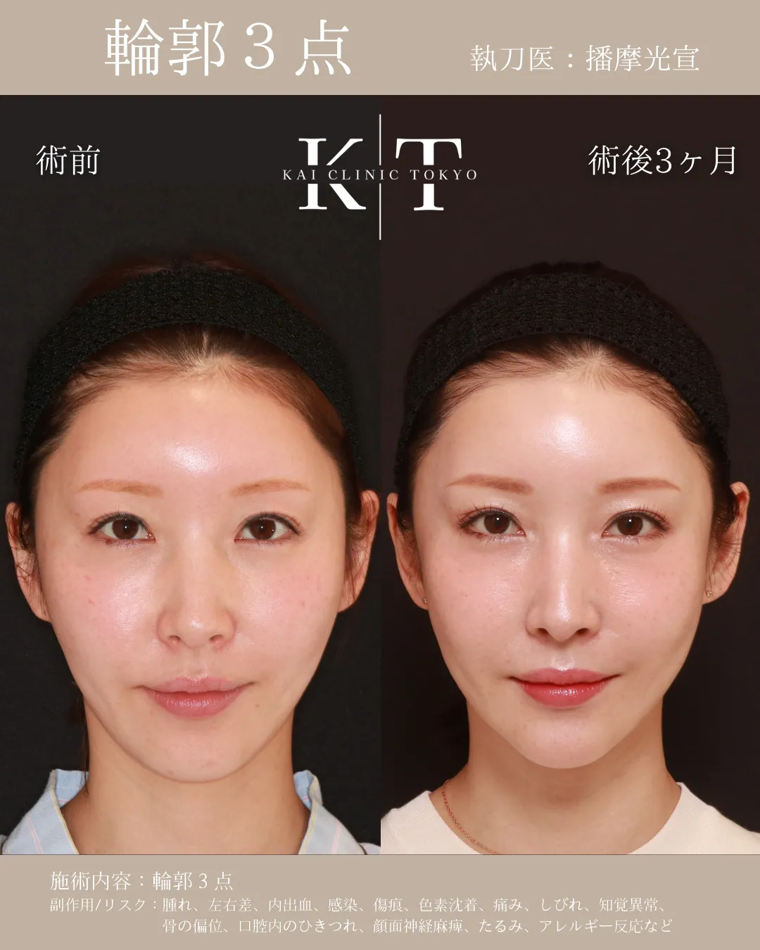 輪郭3点【30代女性】