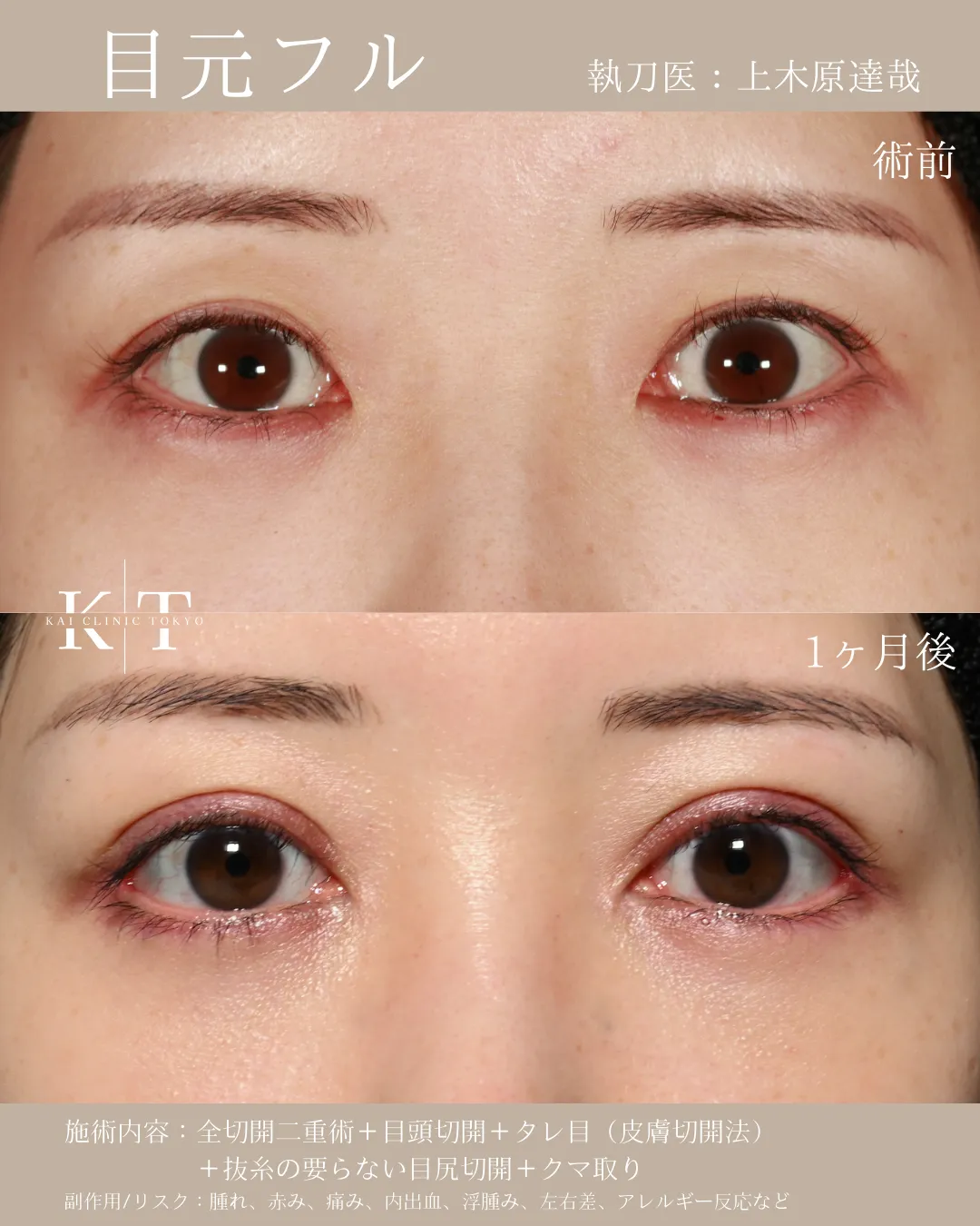 目元フル【女性】