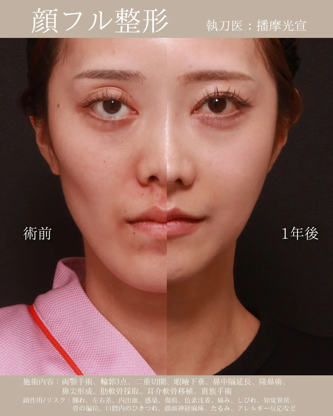 顔フル【女性】