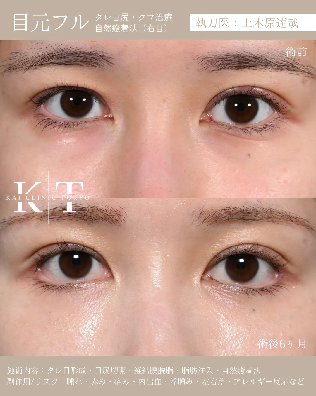 目元フル【20代女性】